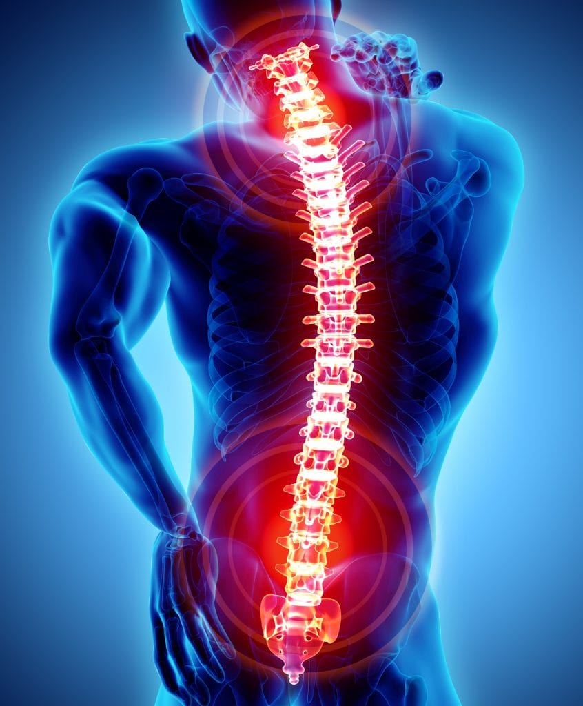 What are the effects of Spine Surgery?